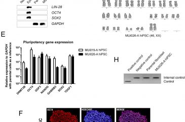 Generation of human induced pluripotent stem cell line (MUi026-A) from a patient with autosomal dominant polycystic kidney disease carrying PKD1 point mutation