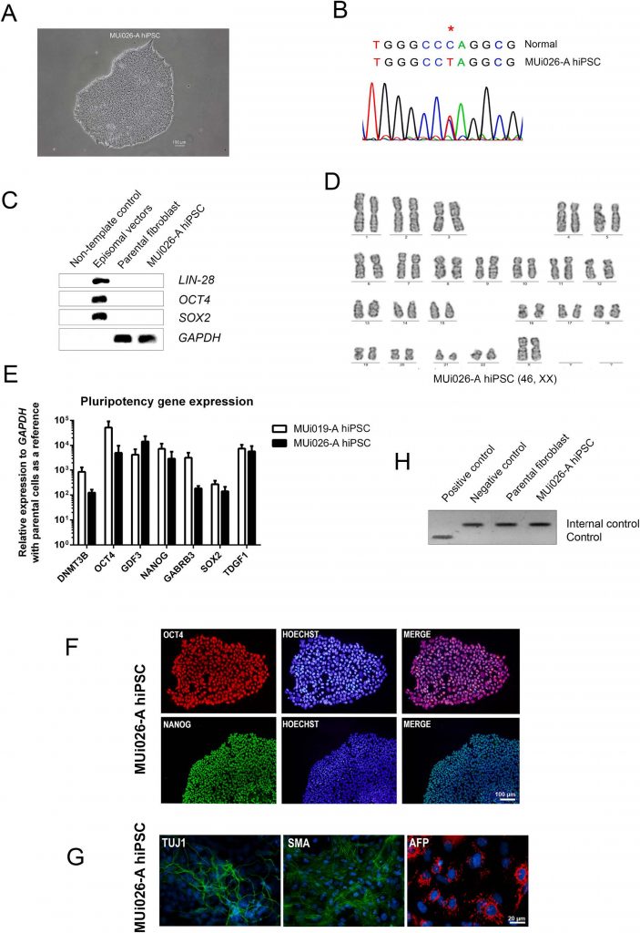 Generation of human induced pluripotent stem cell line (MUi026-A) from a patient with autosomal dominant polycystic kidney disease carrying PKD1 point mutation