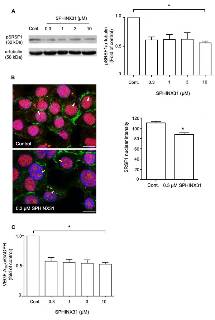 Inhibition of serine/arginine-rich protein kinase-1 (SRPK1) prevents cholangiocarcinoma cells induced angiogenesis