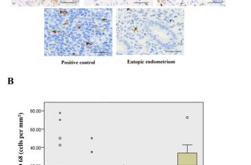 Macrophages and Natural Killer Cells Characteristics in Variously Colored Endometriotic Lesions: A Cross-Sectional Analytic Study